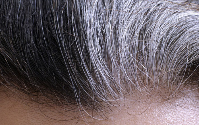 4 vấn đề thường gặp ở tóc: Tóc bạc, rụng, hư tổn, bết